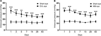 Circular RNA Expression Profiling Identifies Glaucoma-Related Circular RNAs in Various Chronic Ocular Hypertension Rat Models